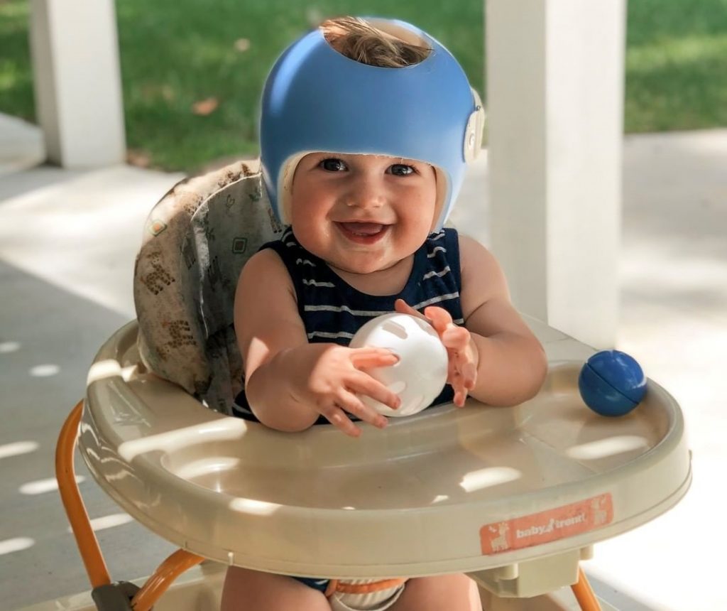 Can An Orthotic Helmet Cure Craniosynostosis Cranial Therapy Centers