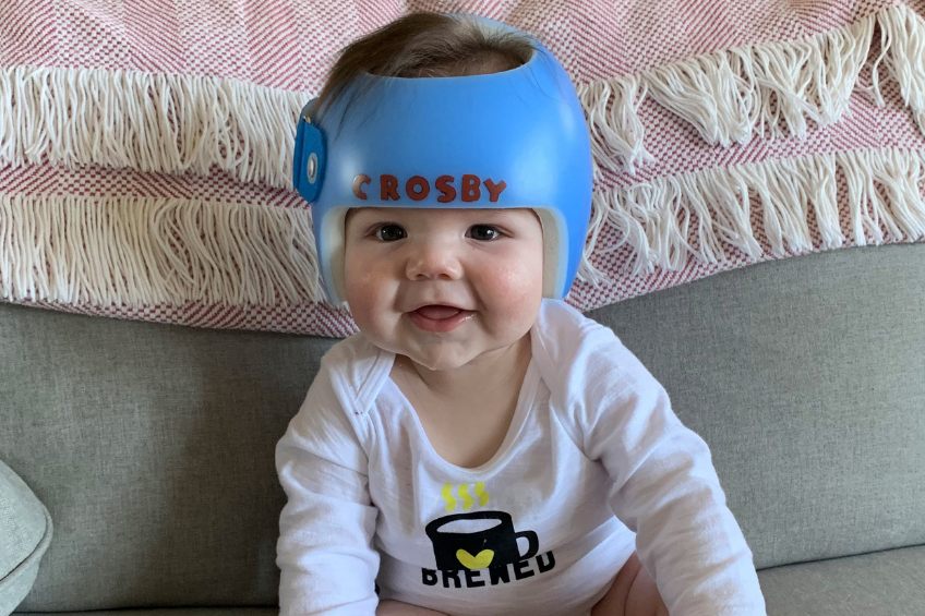 Why babies have sales to wear helmets