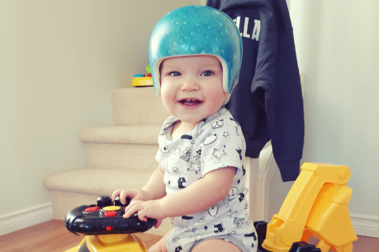 Questions You May Have Before Your Baby Begins Cranial Therapy